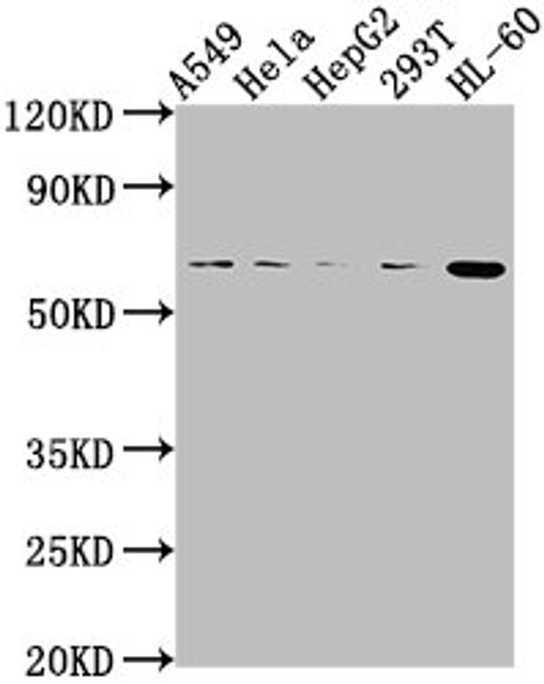 Western Blot. Positive WB detected in: A549 whole cell lysate, Hela whole cell lysate, HepG2 whole cell lysate, 293T whole cell lysate, HL60 whole cell lysate. All lanes: MDM2 antibody at 1:2000. Secondary. Goat polyclonal to rabbit IgG at 1/50000 dilution. Predicted band size: 56, 34, 31, 25, 36, 15, 12, 49, 50 kDa. Observed band size: 56 kDa