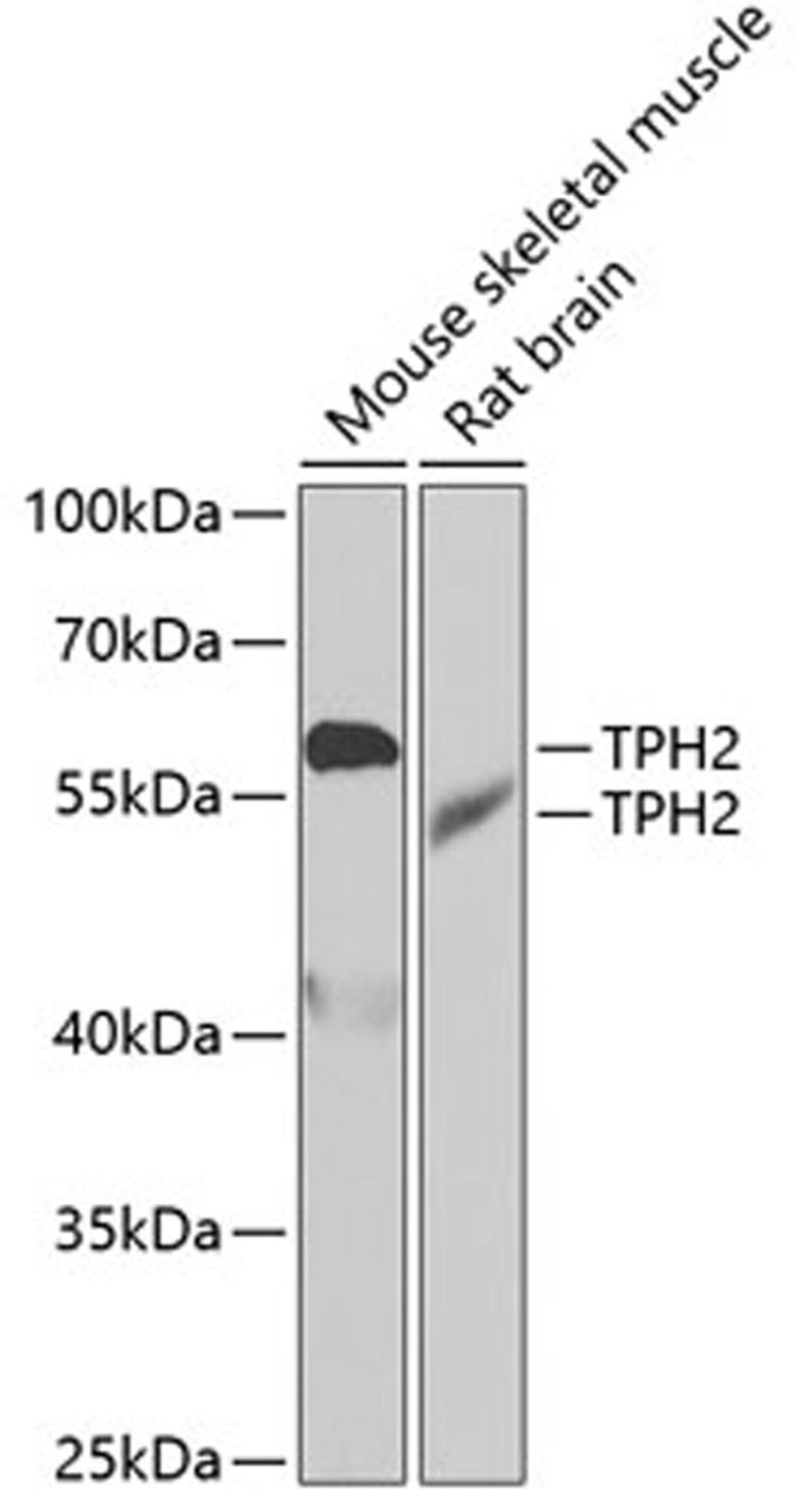 Western blot - TPH2 antibody (A7147)