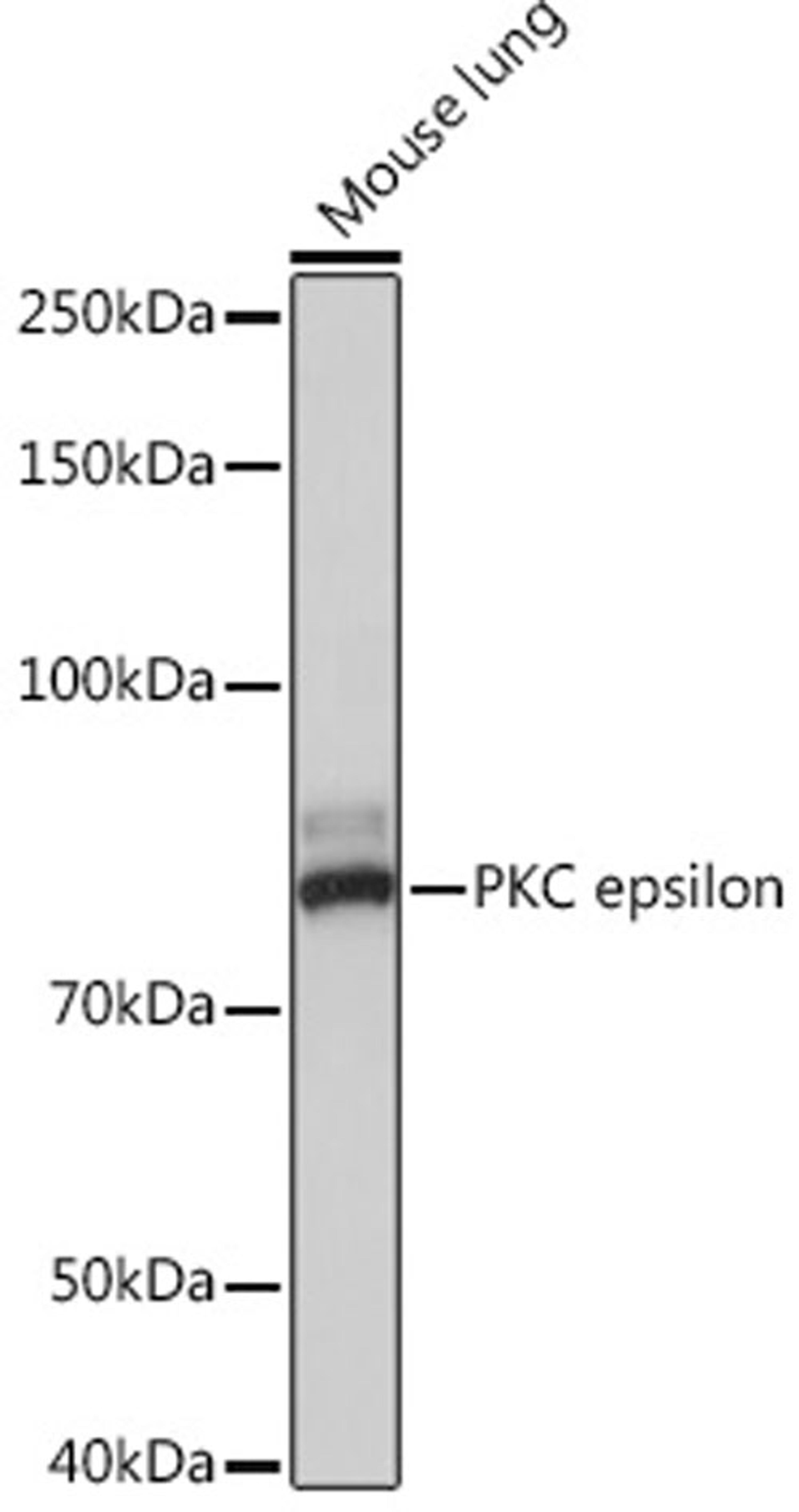 Western blot - PKC epsilon Rabbit mAb (A4998)