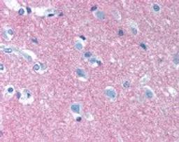 Immunohistochemistry staining of NCAM1 in brain cortex tissue using NCAM1 monoclonal Antibody.