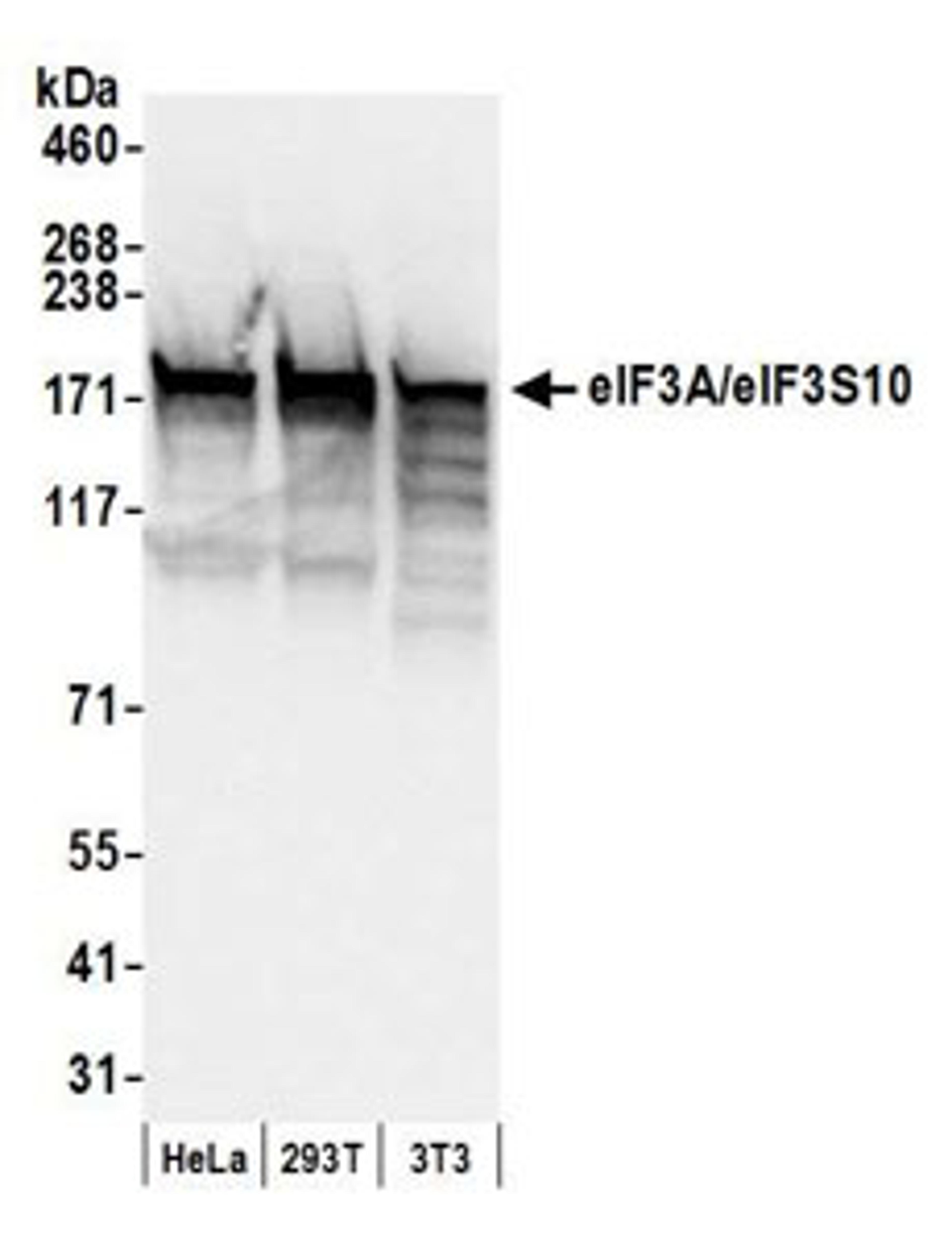 Detection of human and mouse eIF3A/eIF3S10 by western blot.