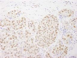 Detection of human Rtf1 by immunohistochemistry.