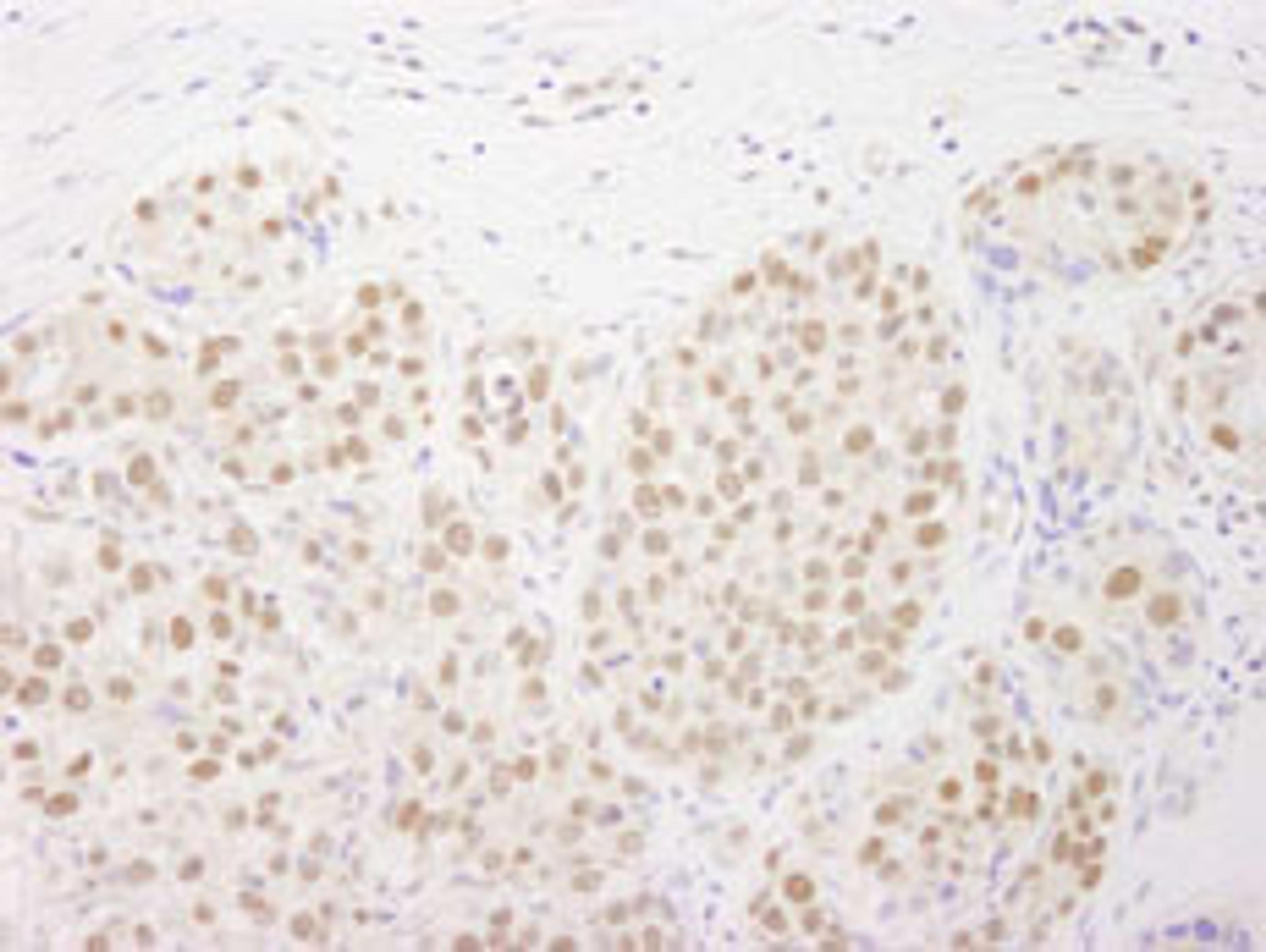 Detection of human Rtf1 by immunohistochemistry.