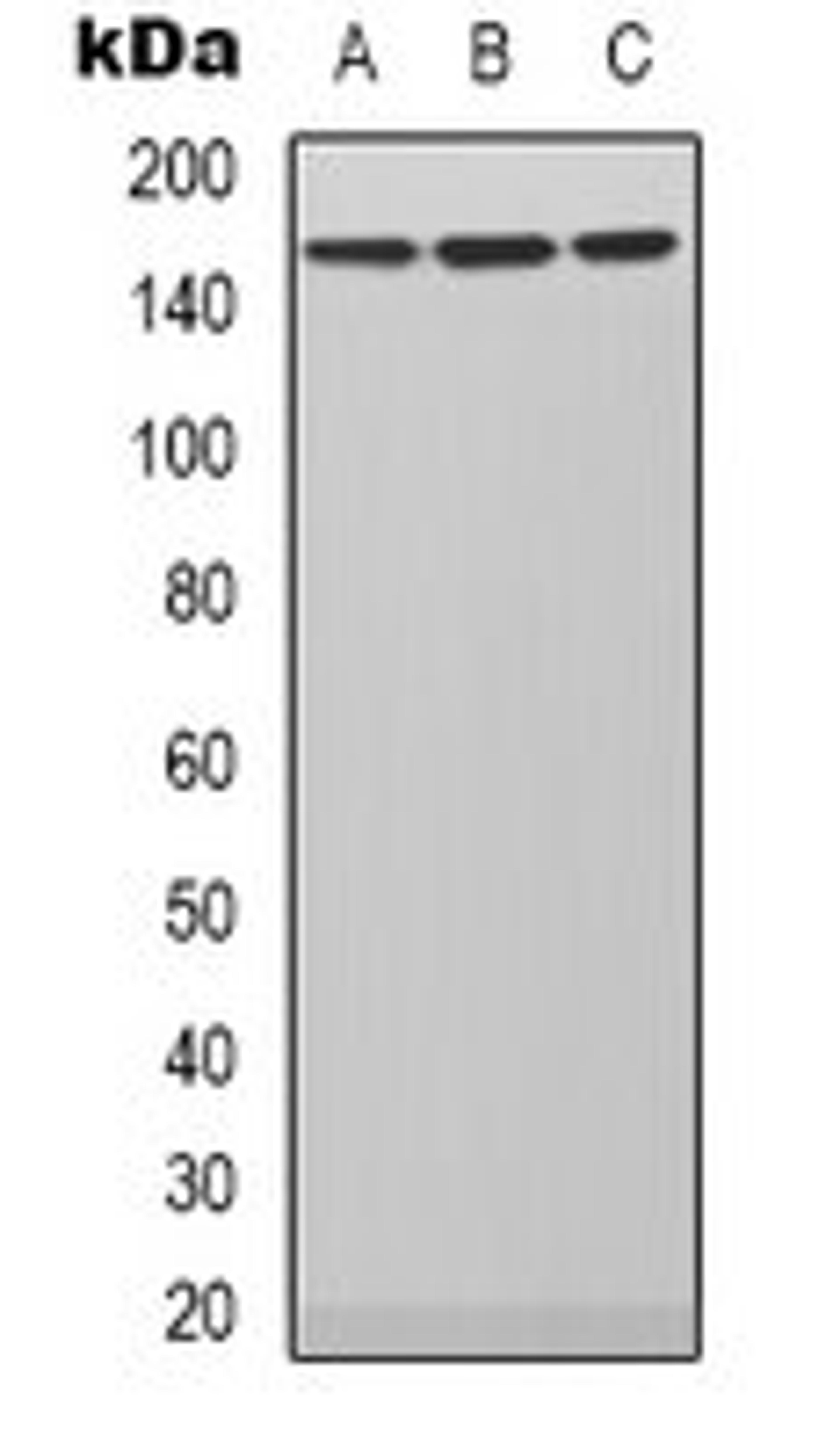 Western blot analysis of SHSY5Y (Lane 1), Hela (Lane 2), NIH3T3 (Lane 3) whole cell lysates using PLC beta 3 antibody