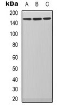 Western blot analysis of SHSY5Y (Lane 1), Hela (Lane 2), NIH3T3 (Lane 3) whole cell lysates using PLC beta 3 antibody