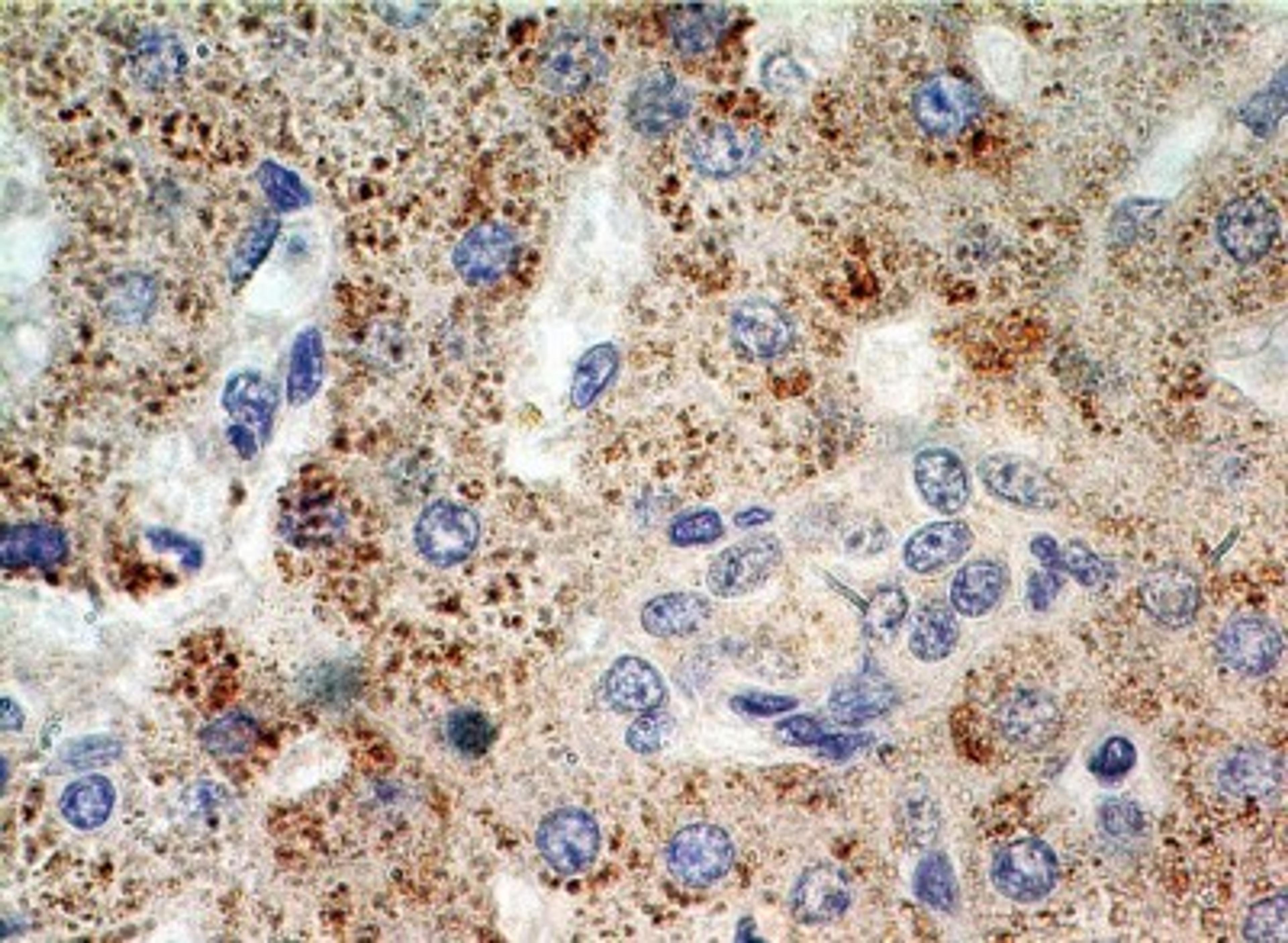 Immunohistochemistry-Paraffin: Exportin 4 Antibody [NB100-56495] - Formalin-fixed, paraffin-embedded human liver stained with TEM8 antibody (5 ug/ml), peroxidase-conjugate and DAB chromogen. Staining of formalin-fixed tissues is enhanced by boiling tissue sections in 10 mM sodium citrate buffer, pH 6.0 for 10-20 min followed by cooling at RT for 20 min.