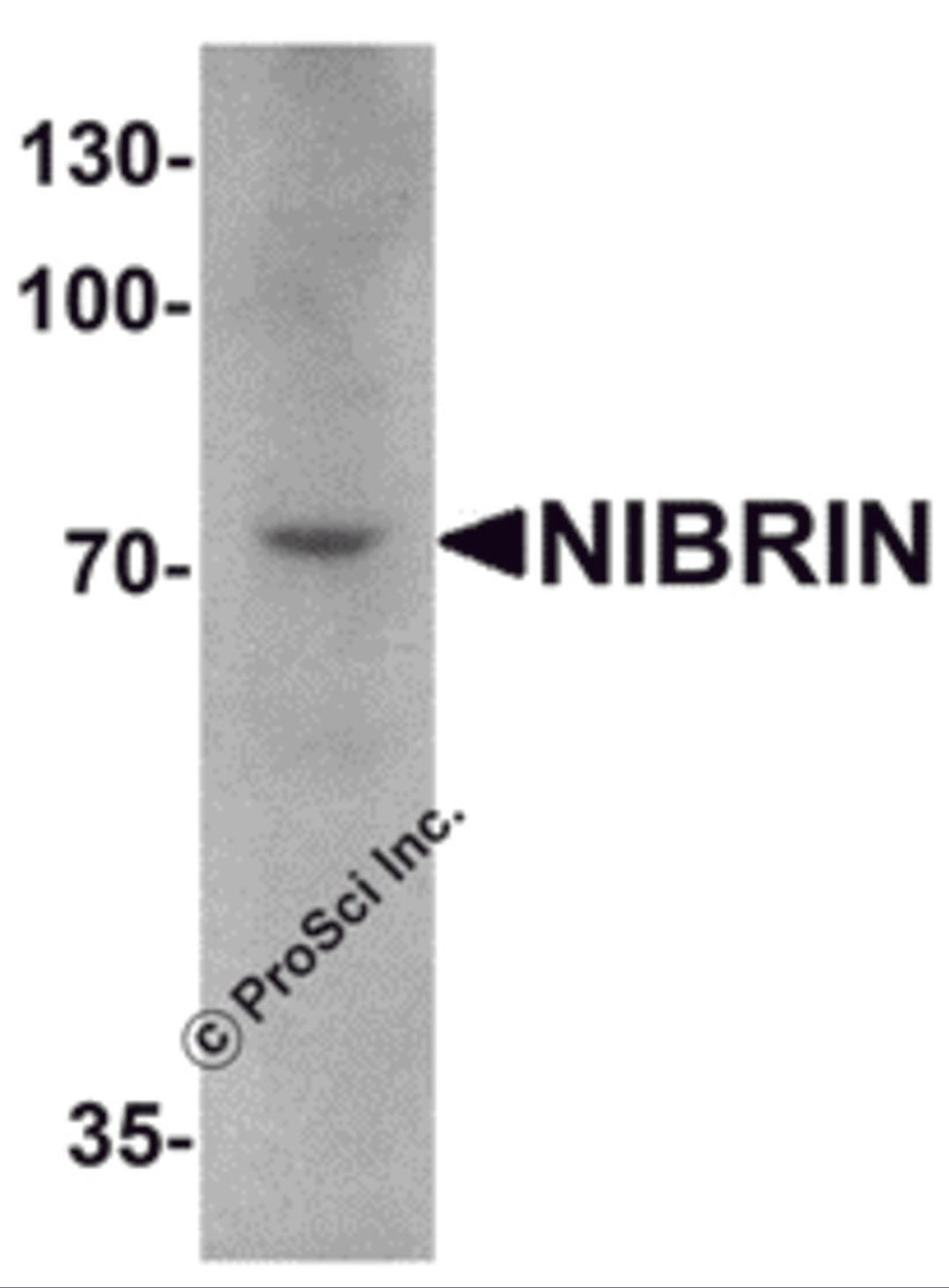 Western blot analysis of NIBRIN in mouse lung tissue lysate with NIBRIN antibody at 1 μg/mL.