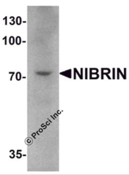 Western blot analysis of NIBRIN in mouse lung tissue lysate with NIBRIN antibody at 1 μg/mL.