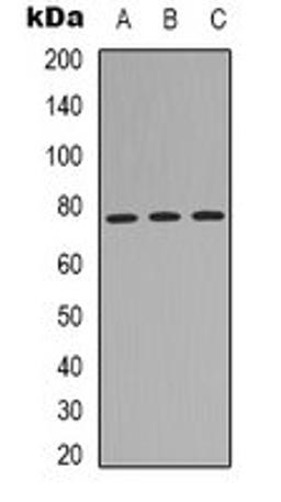 Western blot analysis of HEK293T (Lane 1), A431 (Lane 2), Hela (Lane 3) whole cell lysates using MID1 antibody