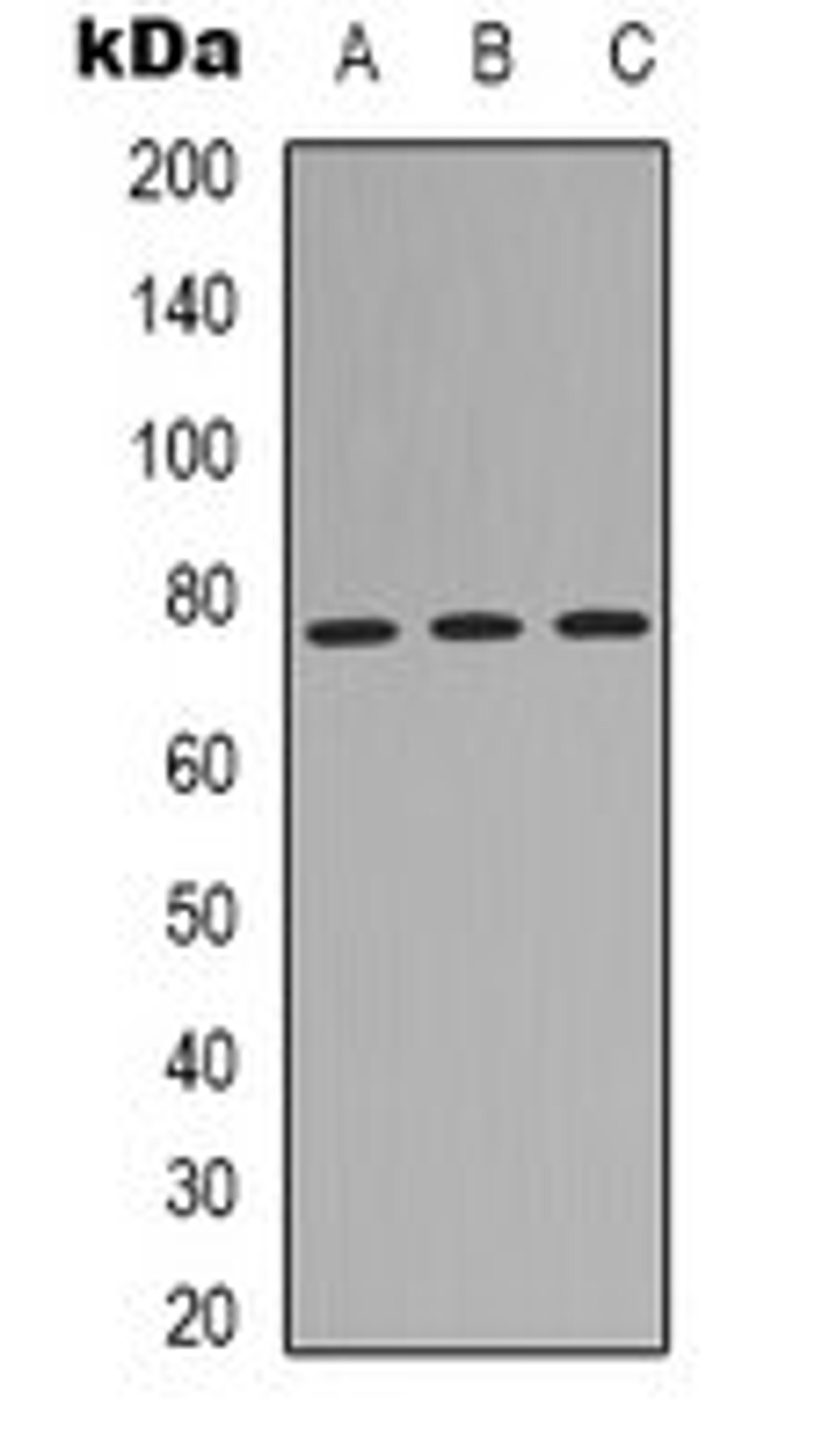 Western blot analysis of HEK293T (Lane 1), A431 (Lane 2), Hela (Lane 3) whole cell lysates using MID1 antibody