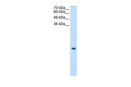 Antibody used in WB on Human Jurkat 0.2-1 ug/ml.