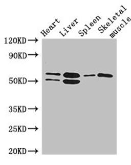 Western Blot. Positive WB detected in: Mouse heart tissue, Mouse liver tissue, Mouse spleen tissue, Mouse skeletal muscle tissue. All lanes: SLC15A3 antibody at 5ug/ml. Secondary. Goat polyclonal to rabbit IgG at 1/50000 dilution. Predicted band size: 64 kDa. Observed band size: 64, 50 kDa.