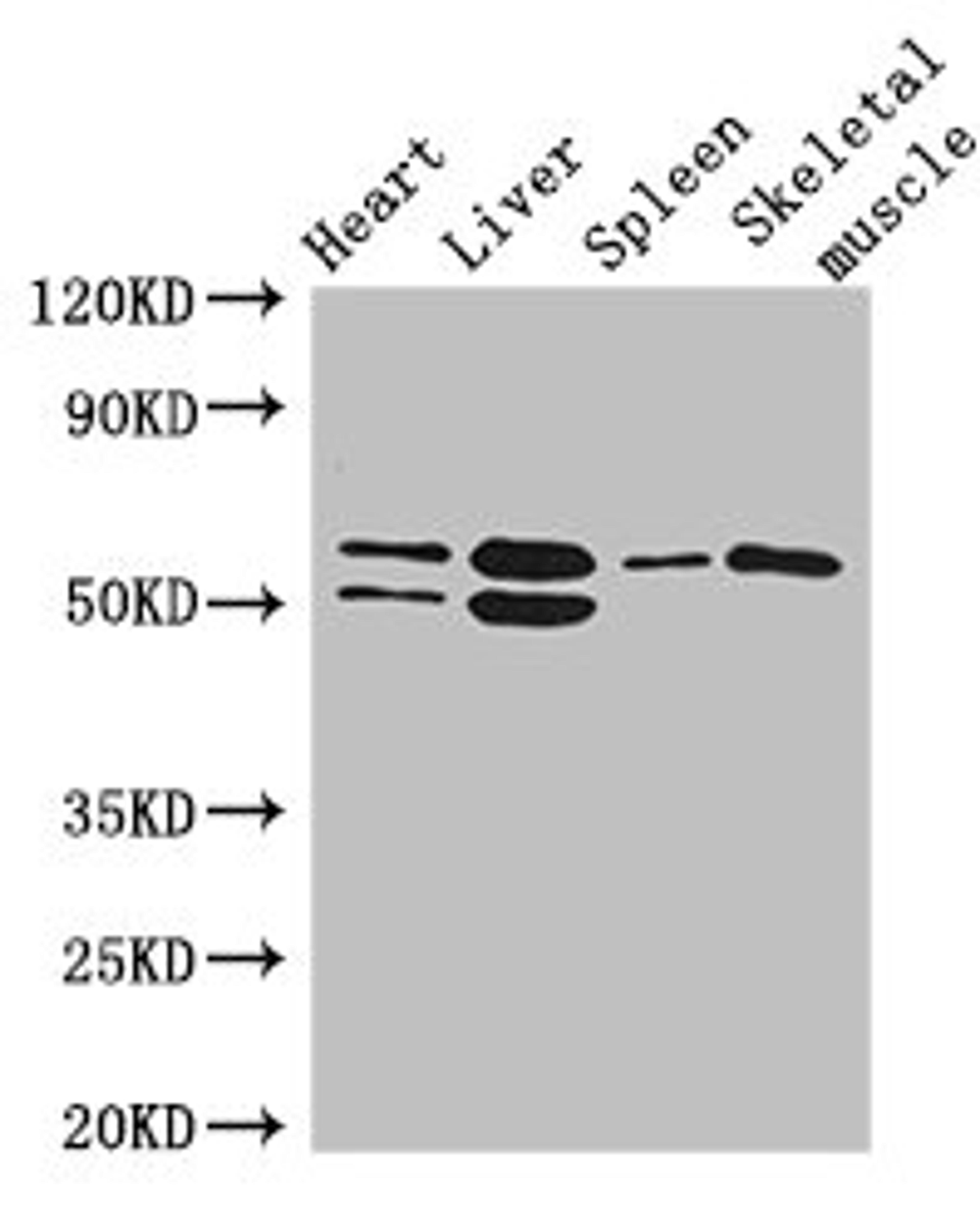 Western Blot. Positive WB detected in: Mouse heart tissue, Mouse liver tissue, Mouse spleen tissue, Mouse skeletal muscle tissue. All lanes: SLC15A3 antibody at 5ug/ml. Secondary. Goat polyclonal to rabbit IgG at 1/50000 dilution. Predicted band size: 64 kDa. Observed band size: 64, 50 kDa.