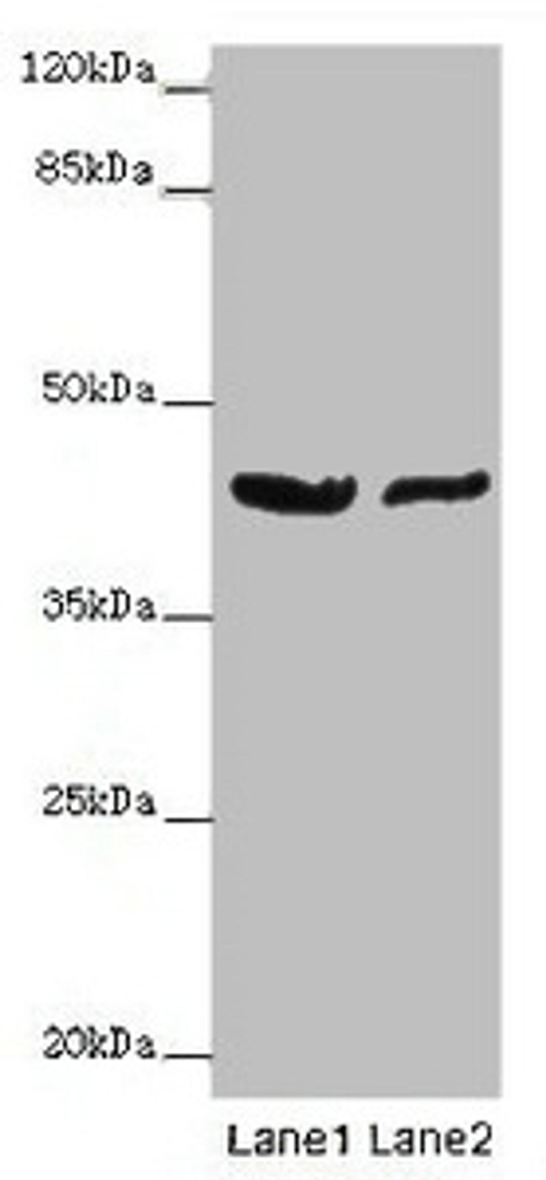 Western blot. All lanes: GATA1 antibody at 7ug/ml. Lane 1: MCF-7 whole cell lysate. Lane 2: A549 whole cell lysate. Secondary. Goat polyclonal to rabbit IgG at 1/10000 dilution. Predicted band size: 43, 36, 35 kDa. Observed band size: 43 kDa. 