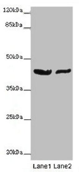 Western blot. All lanes: GATA1 antibody at 7ug/ml. Lane 1: MCF-7 whole cell lysate. Lane 2: A549 whole cell lysate. Secondary. Goat polyclonal to rabbit IgG at 1/10000 dilution. Predicted band size: 43, 36, 35 kDa. Observed band size: 43 kDa. 