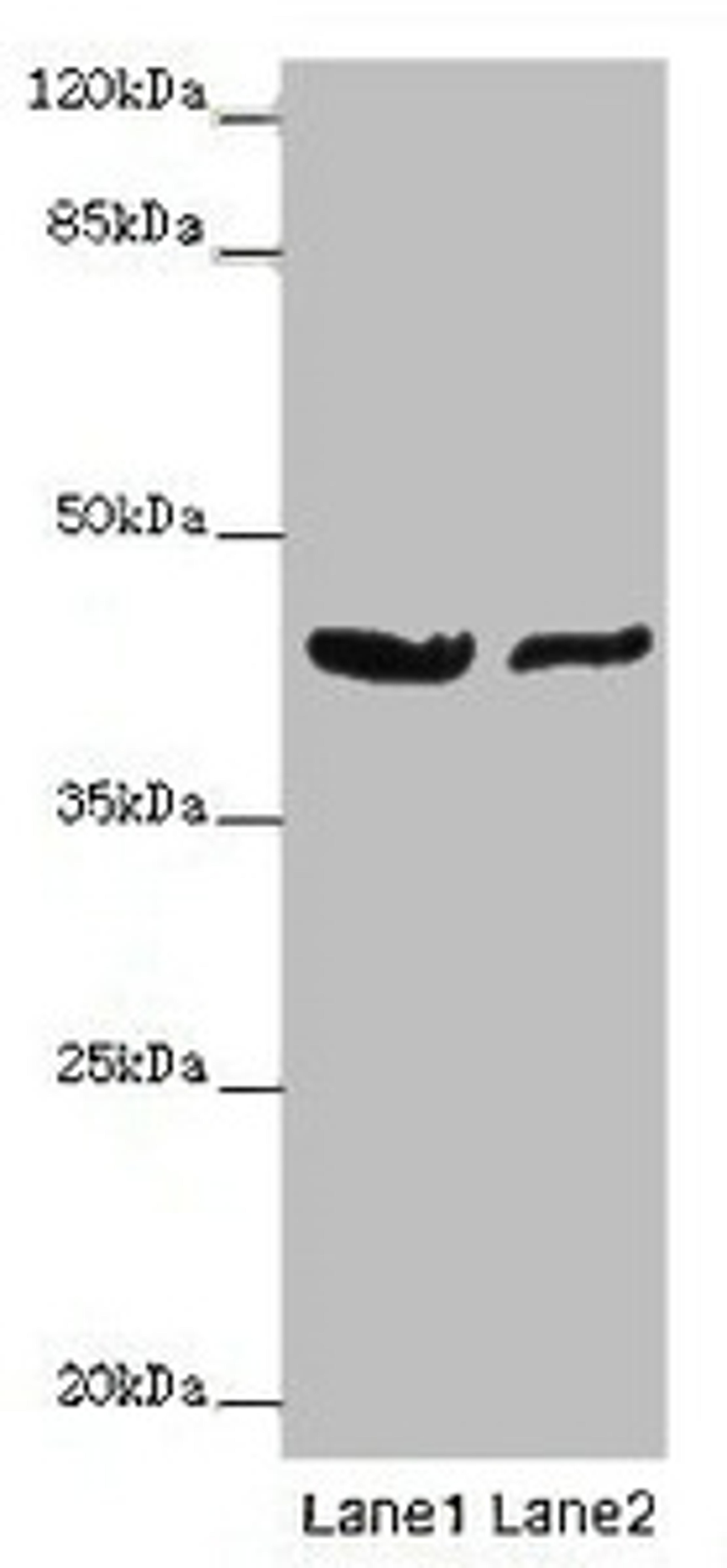 Western blot. All lanes: GATA1 antibody at 7ug/ml. Lane 1: MCF-7 whole cell lysate. Lane 2: A549 whole cell lysate. Secondary. Goat polyclonal to rabbit IgG at 1/10000 dilution. Predicted band size: 43, 36, 35 kDa. Observed band size: 43 kDa. 