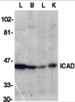Secondary: Goat anti-rabbit IgG HRP conjugate at 1:10000 dilution.