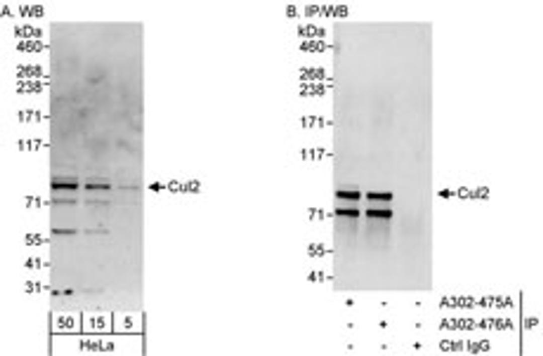 Detection of human Cul2 by western blot and immunoprecipitation.