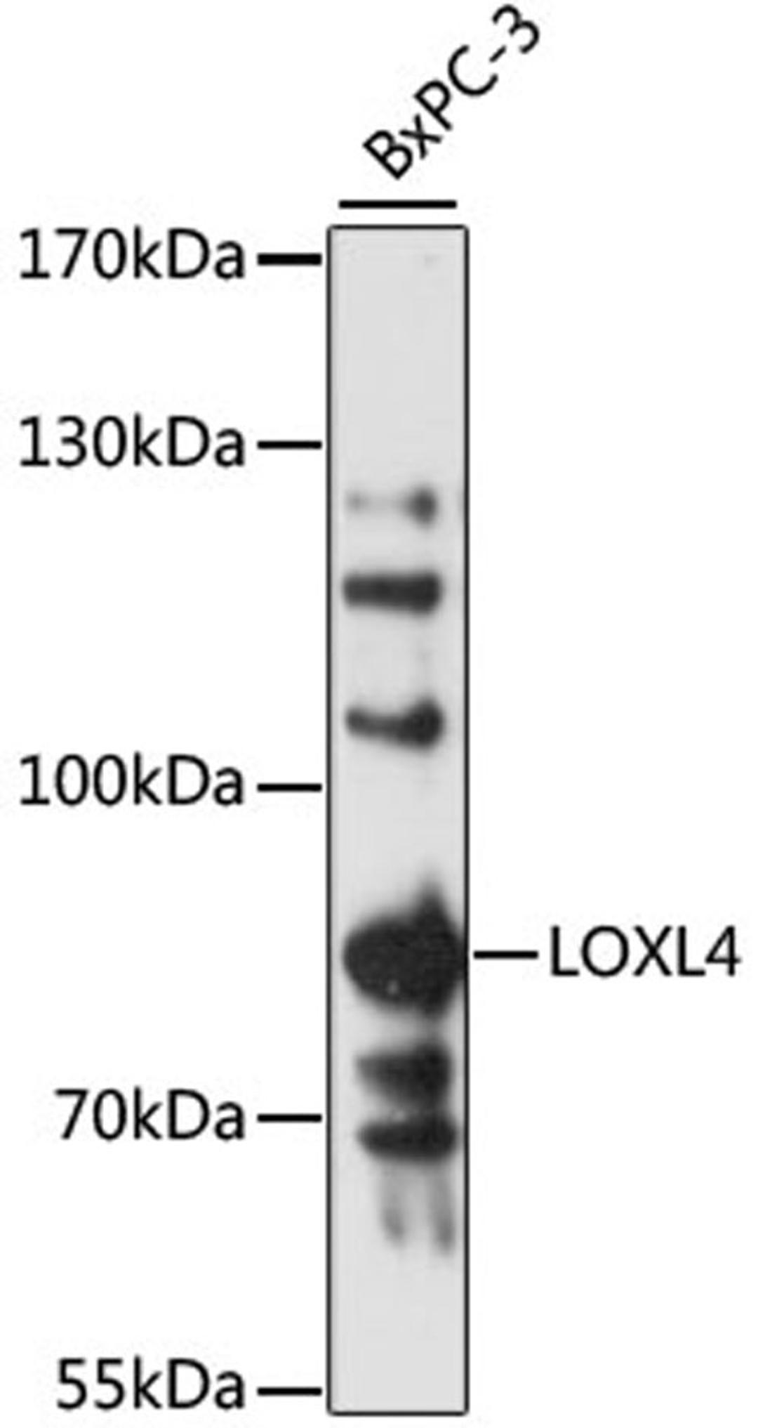 Western blot - LOXL4 antibody (A13131)