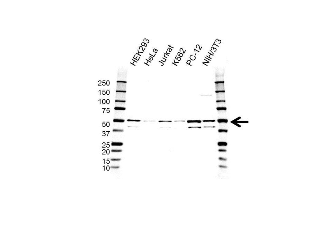 Western blot analysis of whole cell lysates probed with MAPK9 / JNK2 antibody