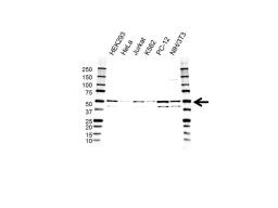 Western blot analysis of whole cell lysates probed with MAPK9 / JNK2 antibody