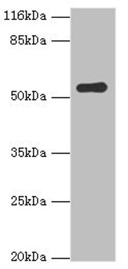 Western blot. All lanes: SIL1 antibody at 2ug/ml + Mouse kidney tissue. Secondary. Goat polyclonal to rabbit IgG at 1/10000 dilution. Predicted band size: 52 kDa. Observed band size: 52 kDa.