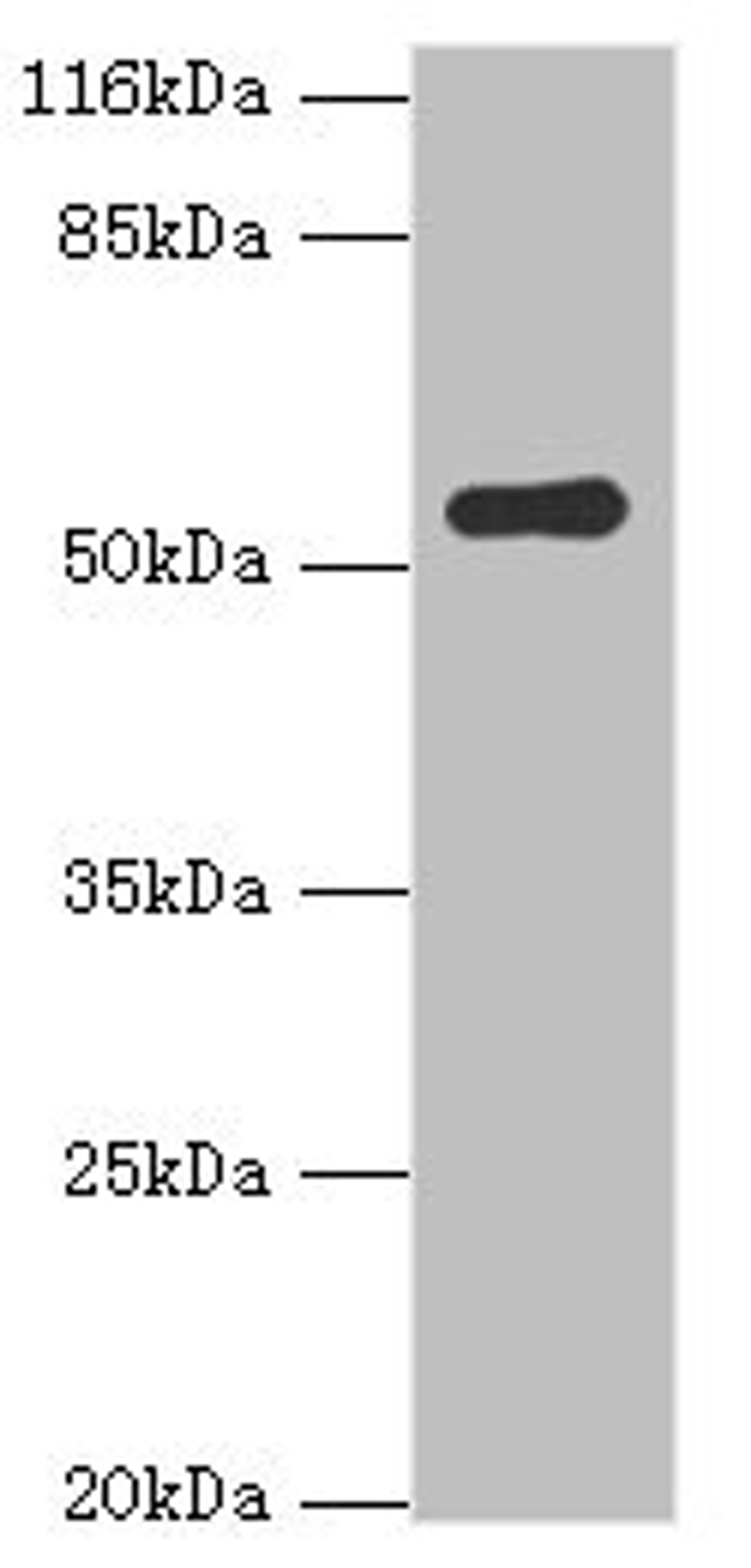 Western blot. All lanes: SIL1 antibody at 2ug/ml + Mouse kidney tissue. Secondary. Goat polyclonal to rabbit IgG at 1/10000 dilution. Predicted band size: 52 kDa. Observed band size: 52 kDa.