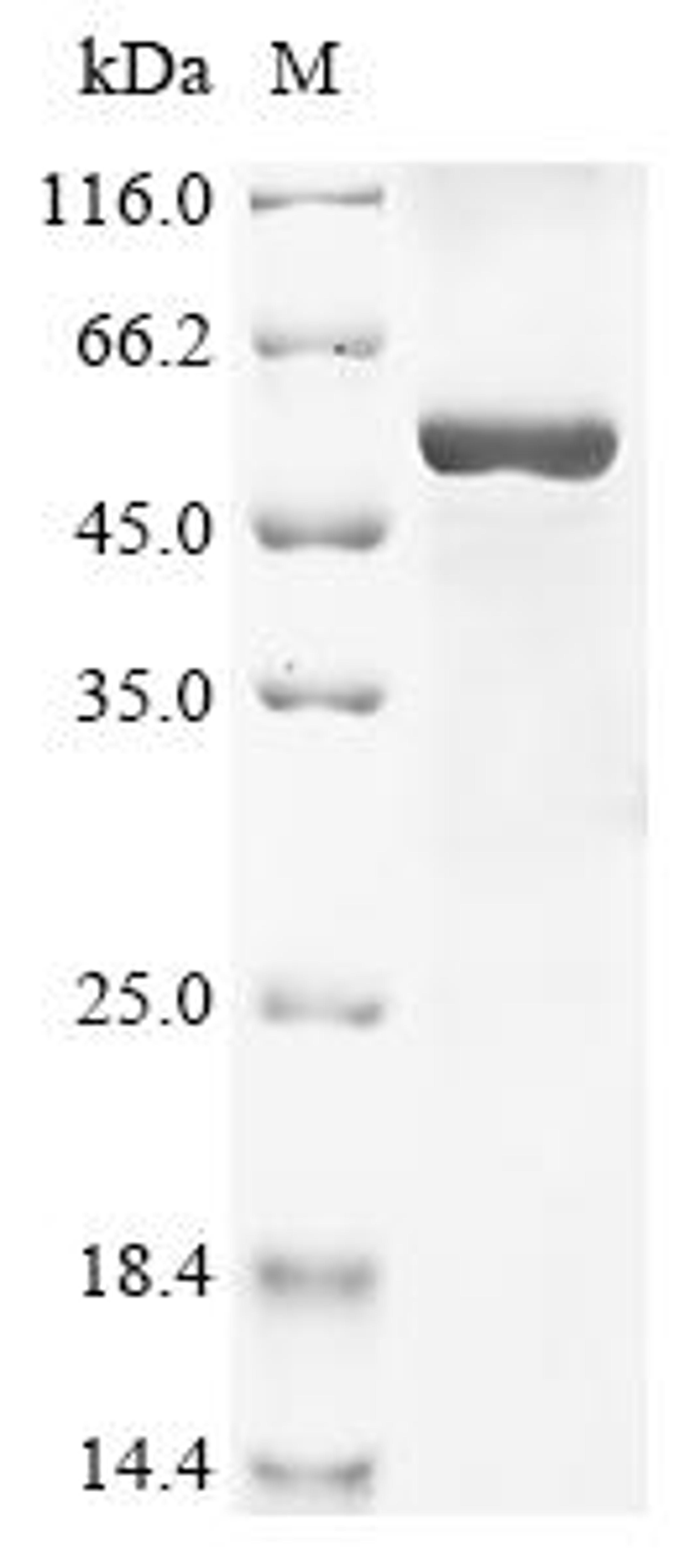 (Tris-Glycine gel) Discontinuous SDS-PAGE (reduced) with 5% enrichment gel and 15% separation gel.