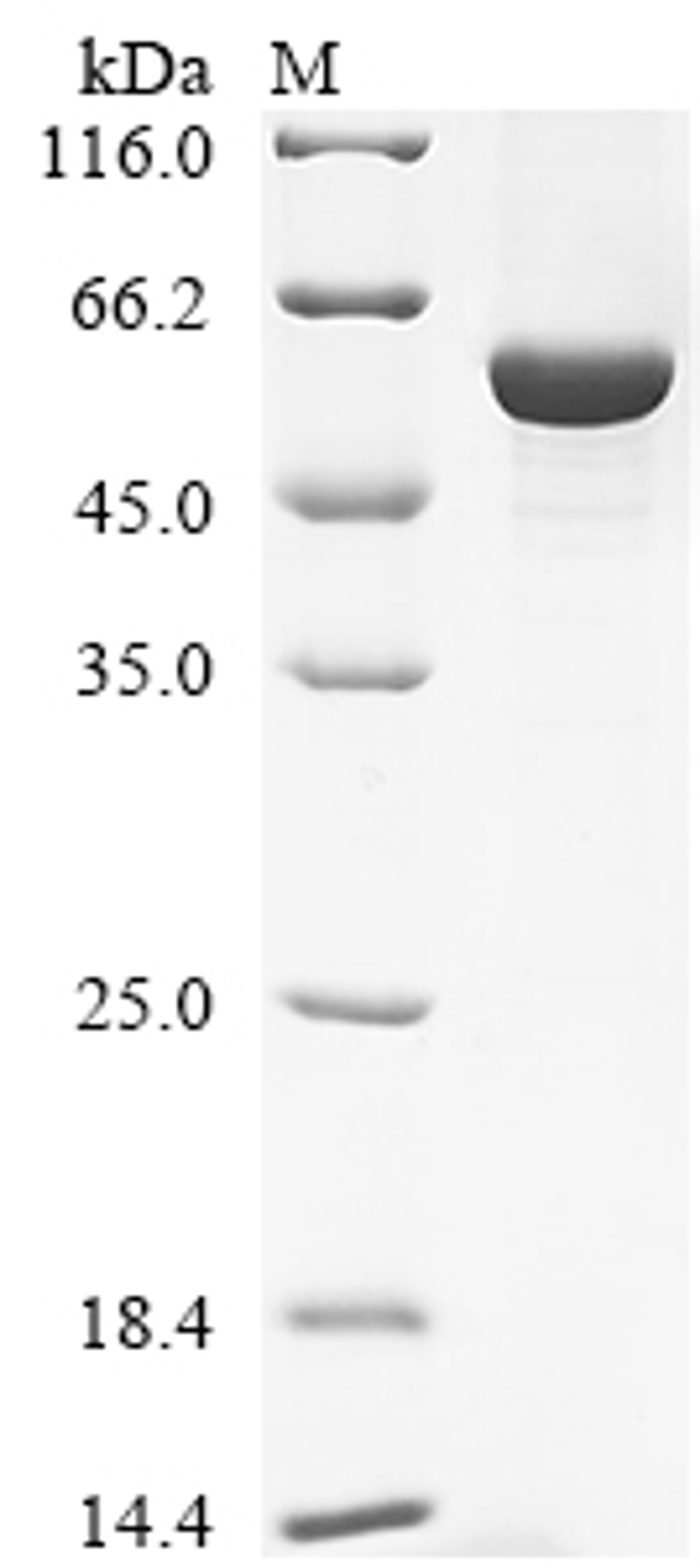 (Tris-Glycine gel) Discontinuous SDS-PAGE (reduced) with 5% enrichment gel and 15% separation gel.