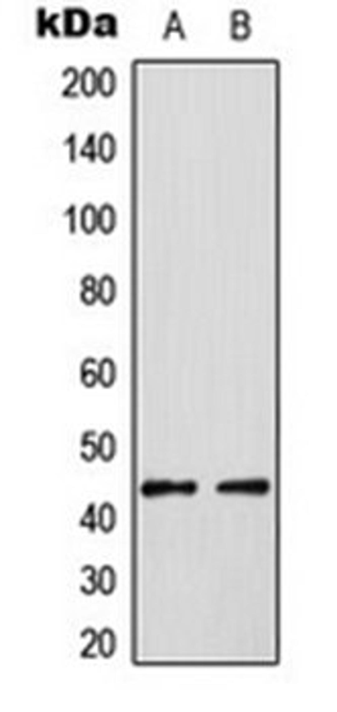 Western blot analysis of HUVEC PMA-treated (Lane 1), HT29 PMA-treated (Lane 2) whole cell lysates using ELK3 antibody