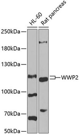 Western blot - WWP2 antibody (A6789)