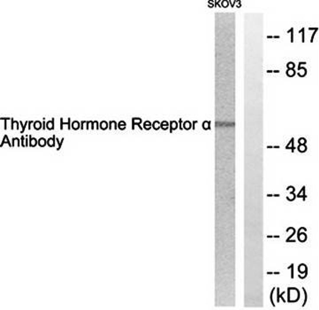 Western blot analysis of extracts from SKOV3 cells using Thyroid Hormone Receptor alpha antibody