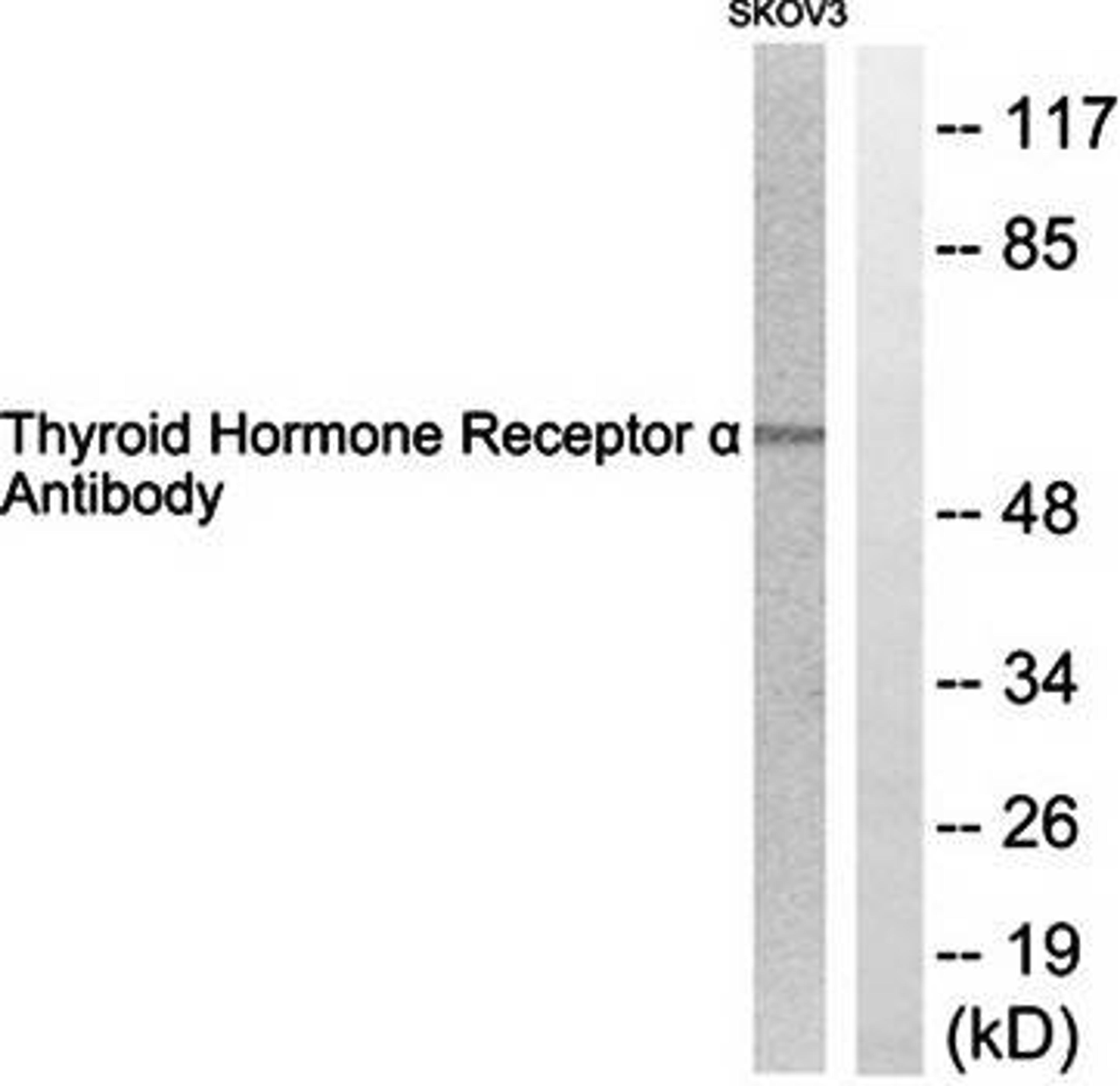 Western blot analysis of extracts from SKOV3 cells using Thyroid Hormone Receptor alpha antibody