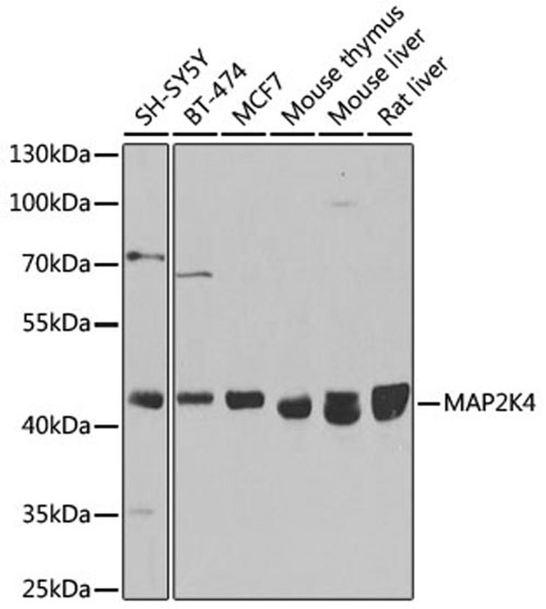 Western blot - MAP2K4 antibody (A14781)