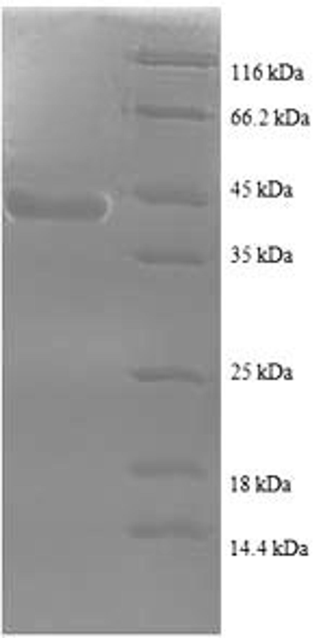 (Tris-Glycine gel) Discontinuous SDS-PAGE (reduced) with 5% enrichment gel and 15% separation gel.