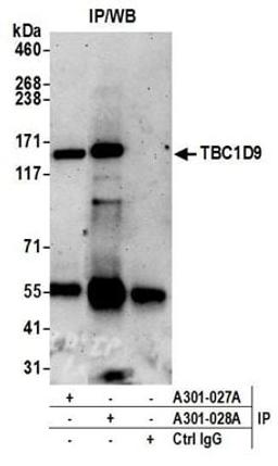 Detection of human TBC1D9 by western blot of immunoprecipitates.