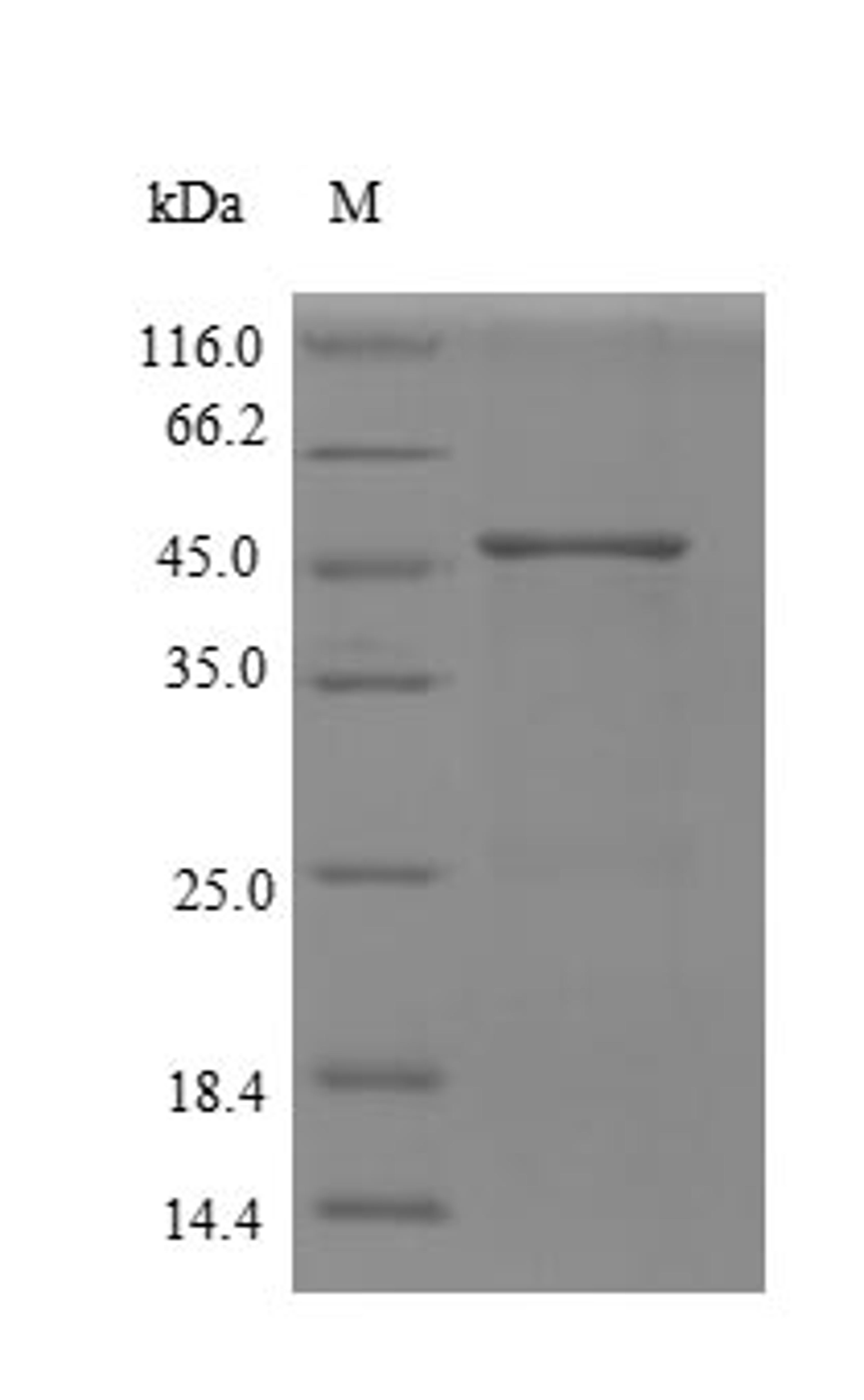 (Tris-Glycine gel) Discontinuous SDS-PAGE (reduced) with 5% enrichment gel and 15% separation gel.