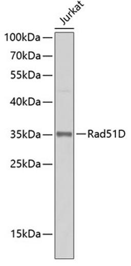 Western blot - Rad51D antibody (A7534)