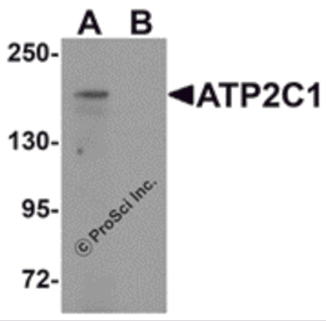 Western blot analysis of ATP2C1 in mouse brain tissue lysate with ATP2C1 antibody at 1 μg/mL in (A) the absence and (B) the presence of blocking peptide.