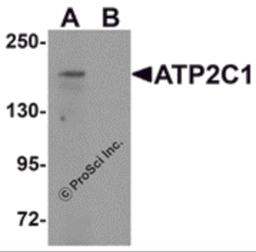 Western blot analysis of ATP2C1 in mouse brain tissue lysate with ATP2C1 antibody at 1 μg/mL in (A) the absence and (B) the presence of blocking peptide.
