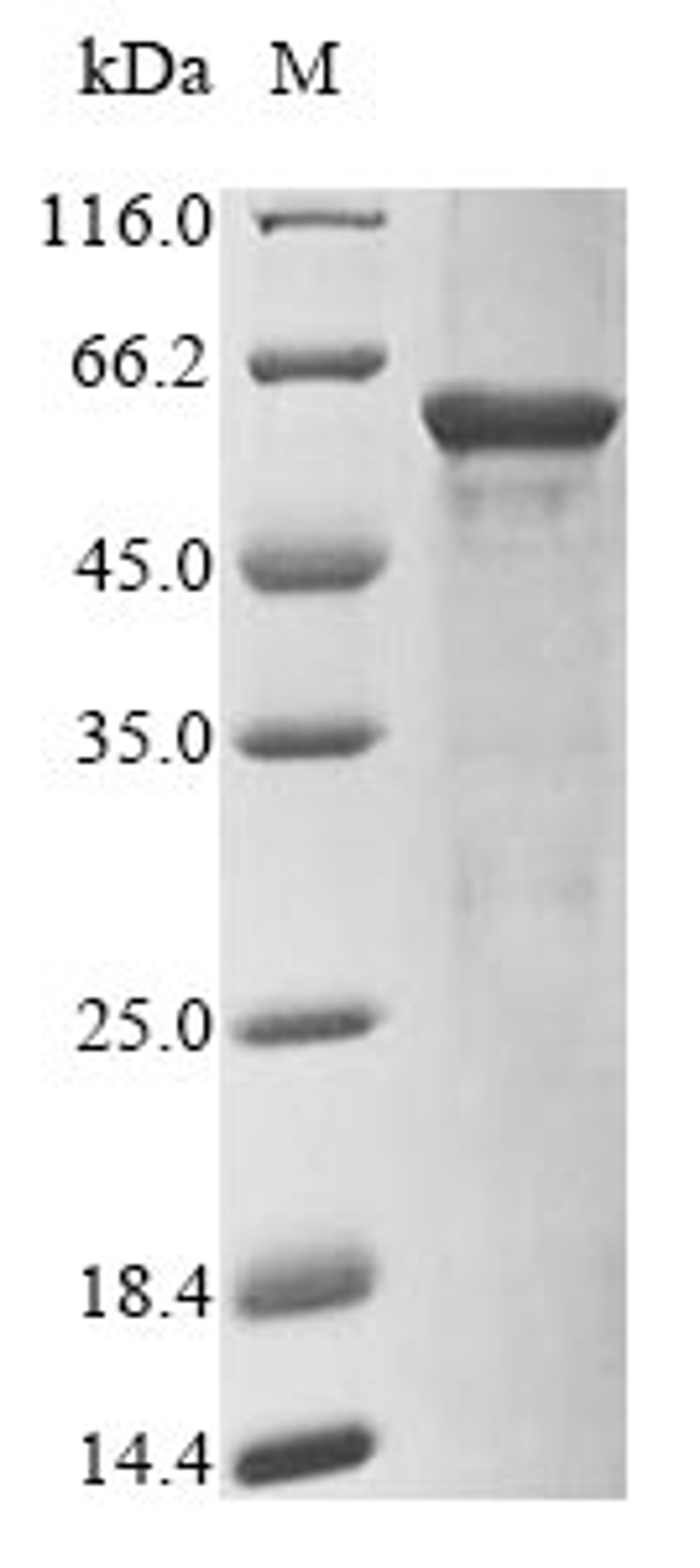 (Tris-Glycine gel) Discontinuous SDS-PAGE (reduced) with 5% enrichment gel and 15% separation gel.