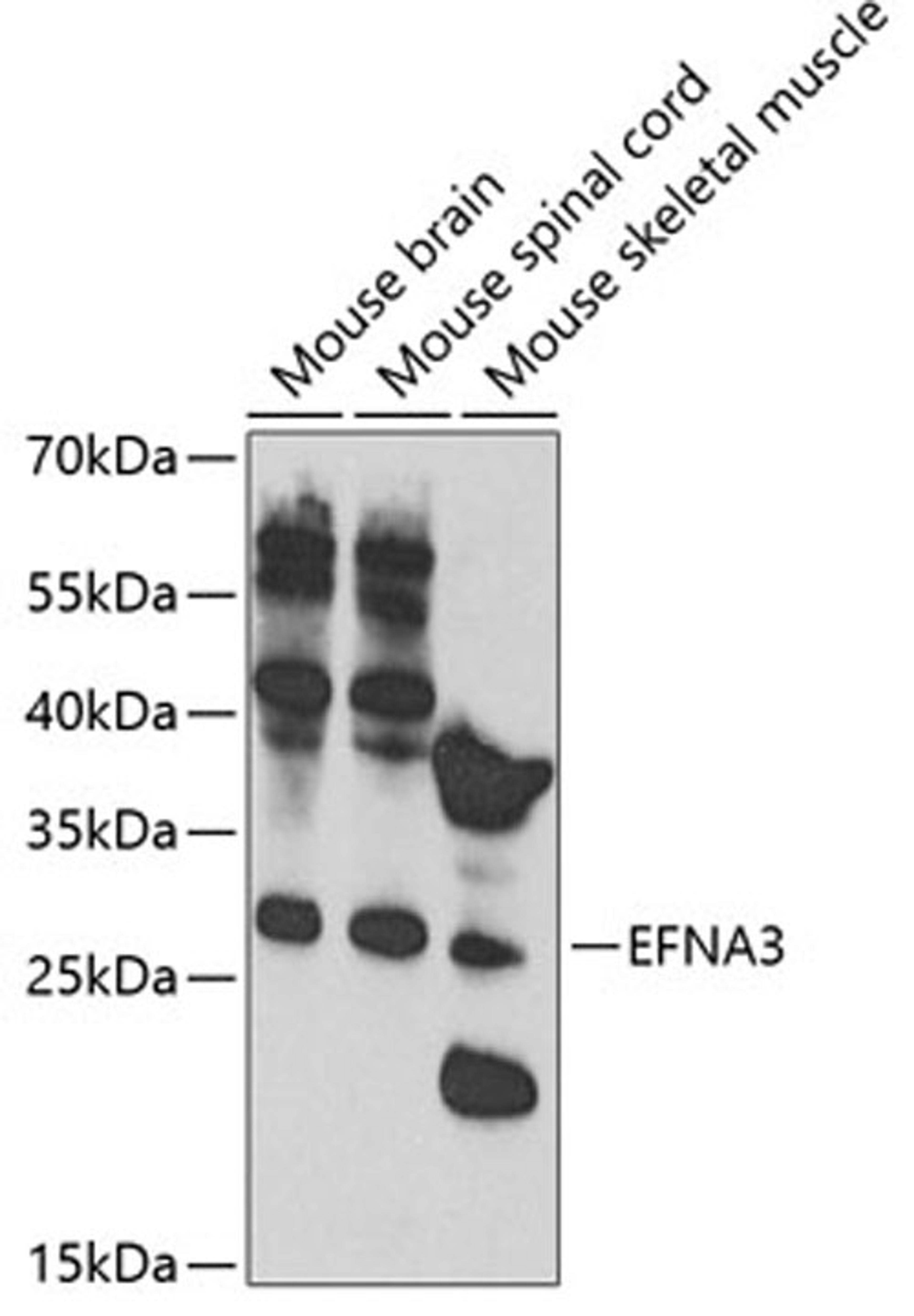 Western blot - EFNA3 antibody (A2724)