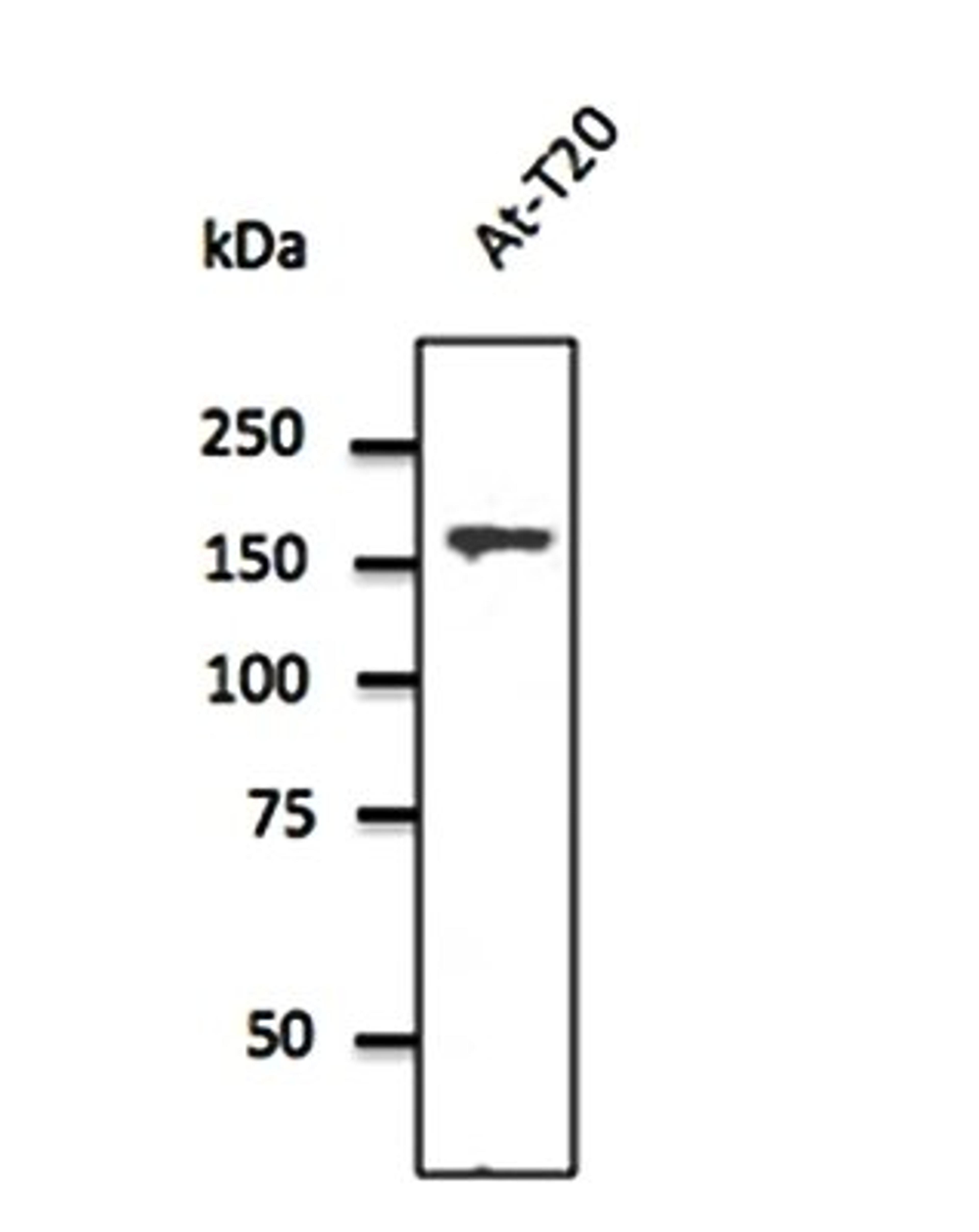 Western blot analysis of At-T20 cell line lysate using Clathrin HC antibody.