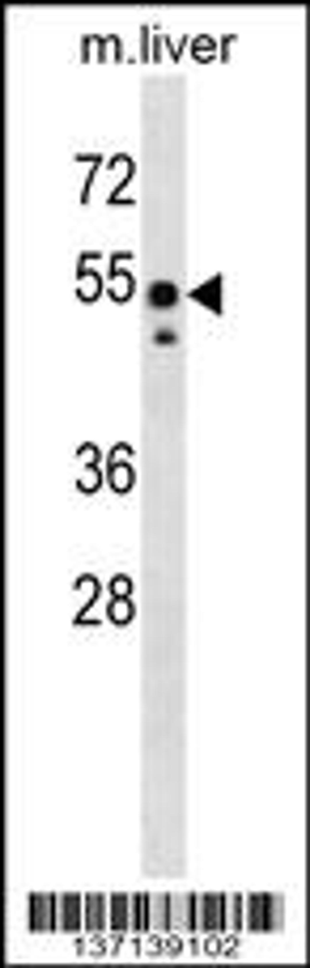 Western blot analysis in mouse liver tissue lysates (35ug/lane).This demonstratedetected the Src protein (arrow).