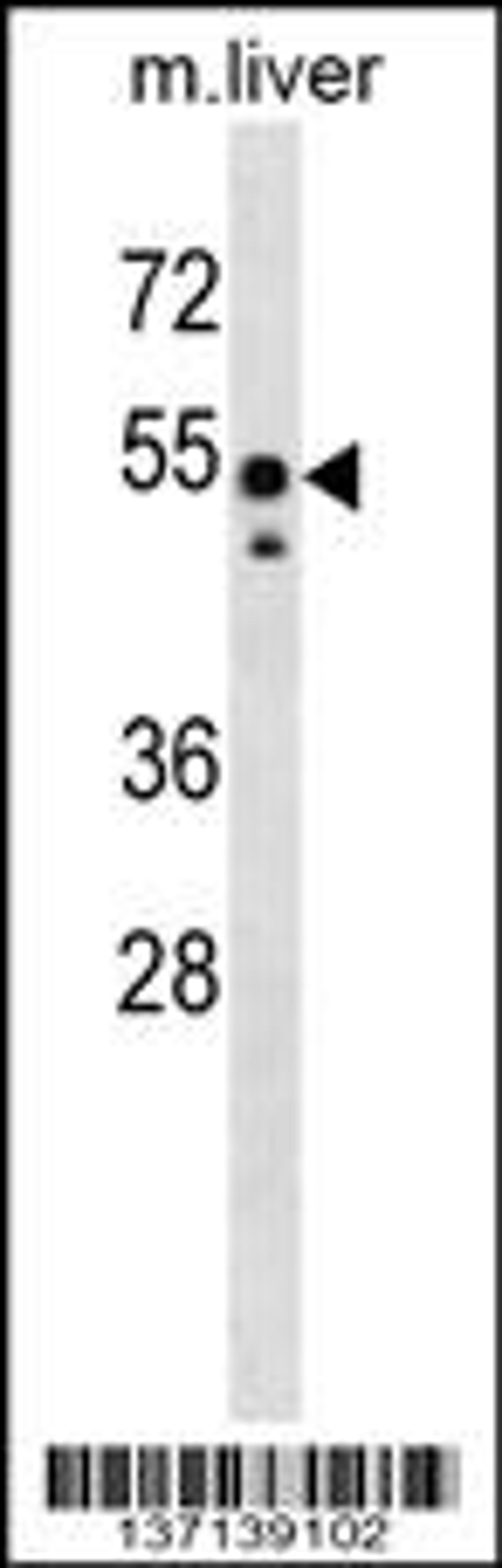 Western blot analysis in mouse liver tissue lysates (35ug/lane).This demonstratedetected the Src protein (arrow).