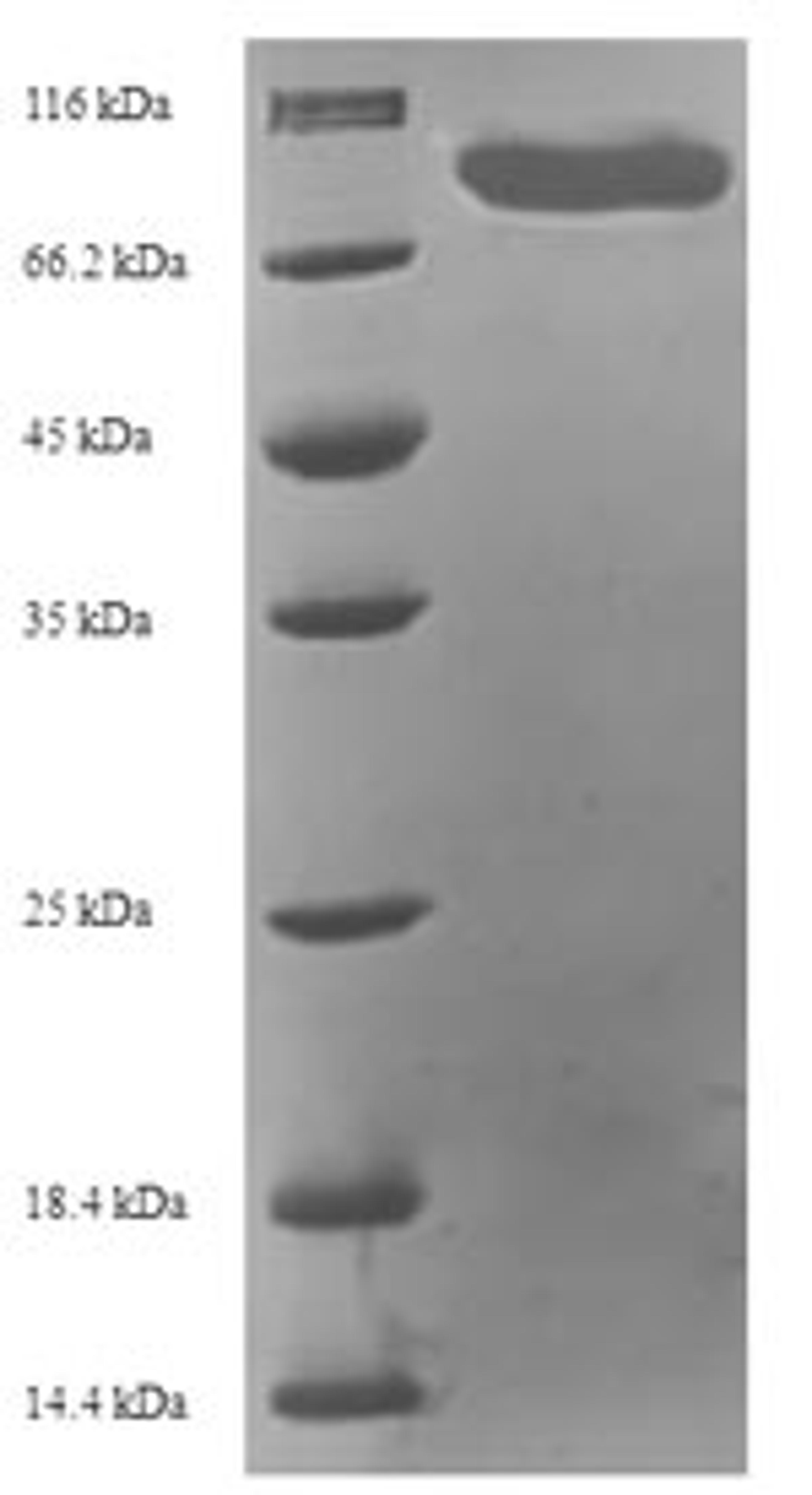 (Tris-Glycine gel) Discontinuous SDS-PAGE (reduced) with 5% enrichment gel and 15% separation gel.