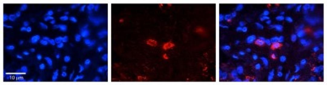 Immunocytochemistry/Immunofluorescence: CLN6 Antibody [NBP1-59415] - Formalin Fixed Paraffin; Embedded Tissue: Human Pineal Tissue; Observed Staining: Cytoplasmic in cell bodies of pinealocytes; Primary Antibody Concentration: 1:100