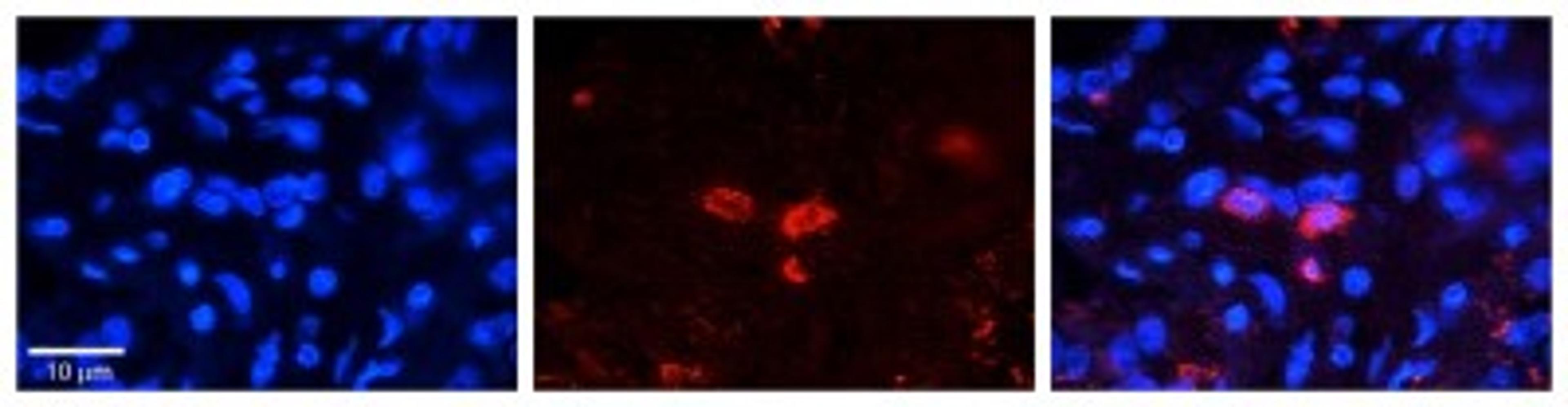 Immunocytochemistry/Immunofluorescence: CLN6 Antibody [NBP1-59415] - Formalin Fixed Paraffin; Embedded Tissue: Human Pineal Tissue; Observed Staining: Cytoplasmic in cell bodies of pinealocytes; Primary Antibody Concentration: 1:100