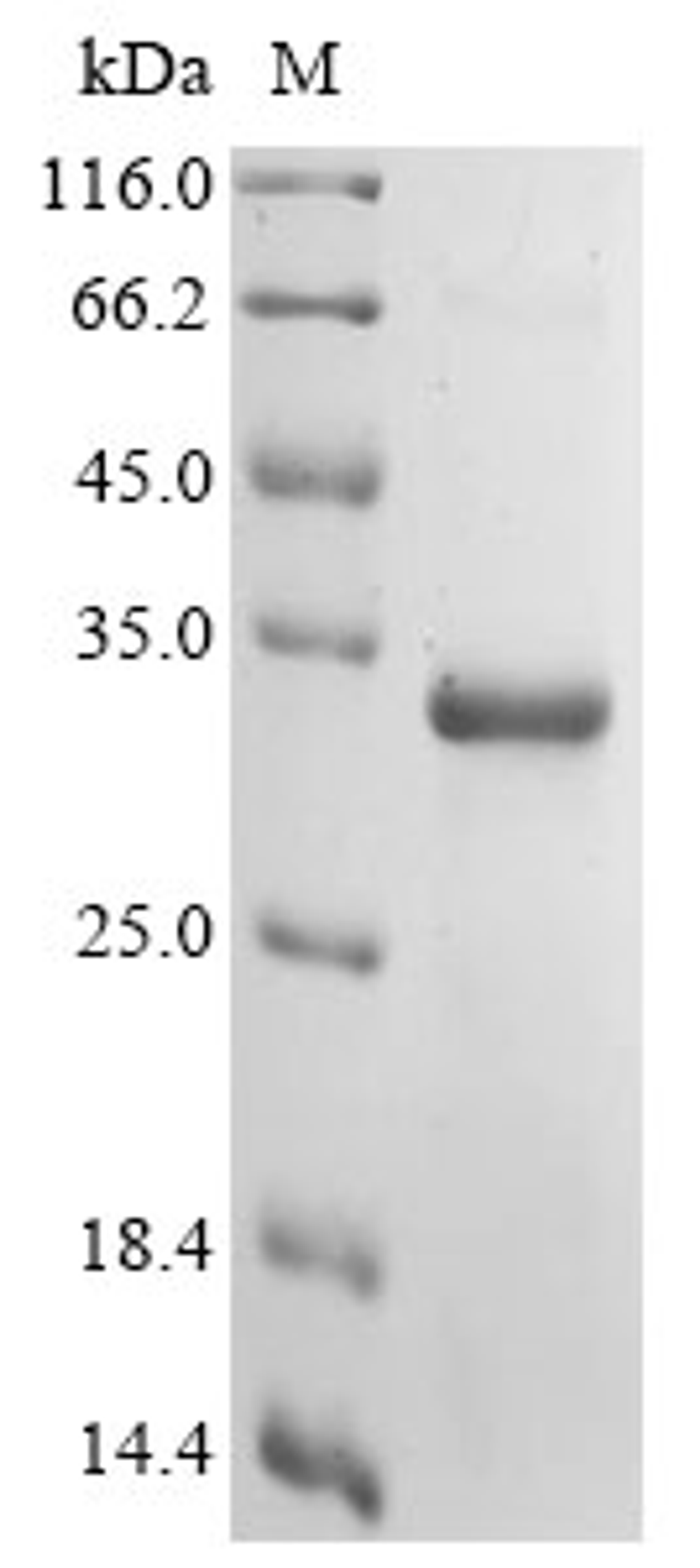 (Tris-Glycine gel) Discontinuous SDS-PAGE (reduced) with 5% enrichment gel and 15% separation gel.