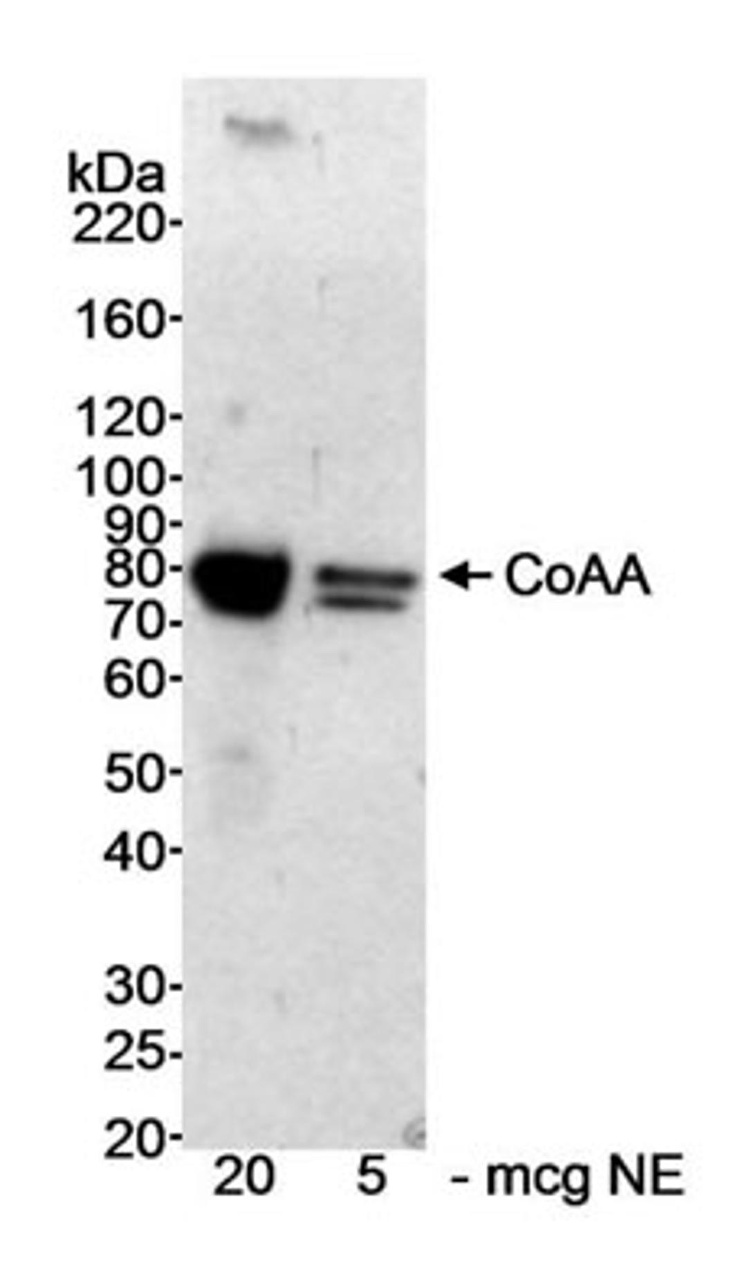 Detection of human CoAA by western blot.